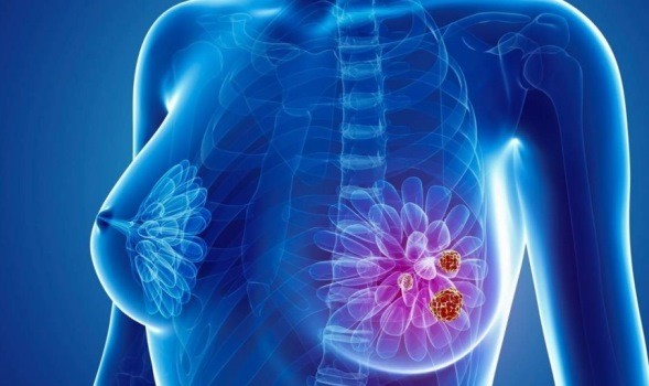 tratamentul articulațiilor mamare serice