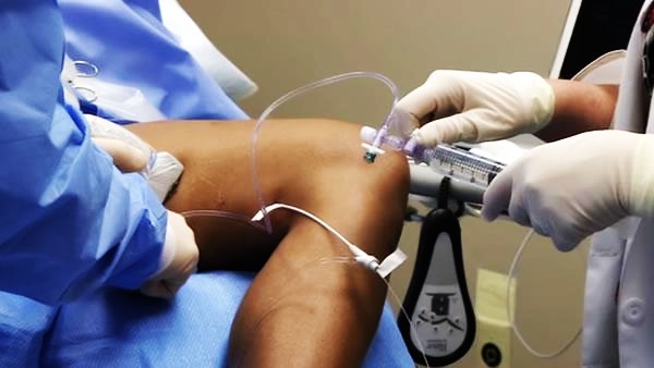tratamentul prețului laser varicoză varicoză lipetsk varicoză organe interne în timpul sarcinii
