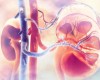 Despre litotritia extracorporeala (ESWL), tratamentul pietrelor la rinichi 