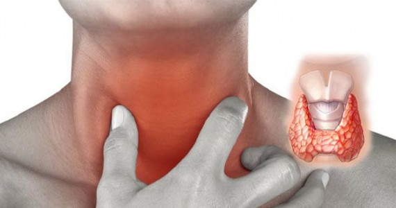 tratament cu iod radioactiv1