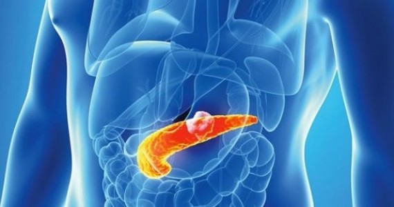 pancreatita acuta_site