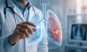Boala pulmonară obstructivă cronică  bpoc