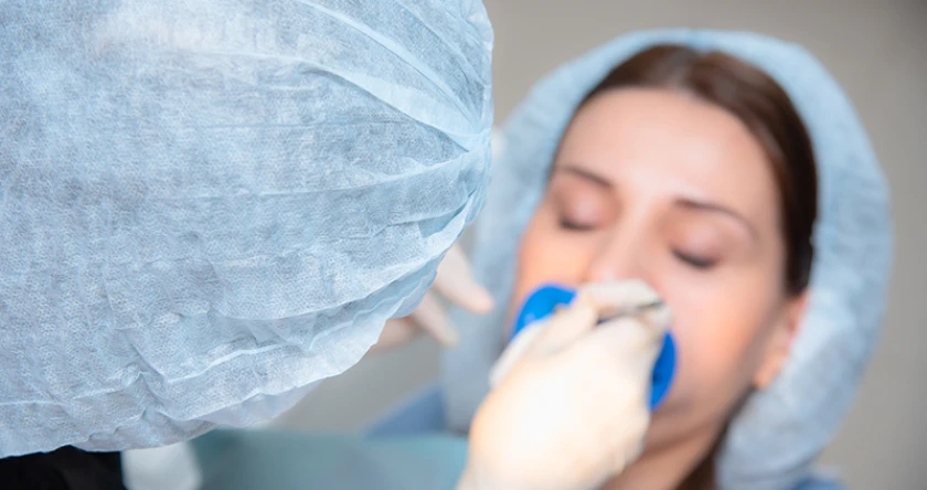 Operatie polipi nazali