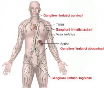 Formele de cancer ale sistemului limfatic - Ganglioni limfatici