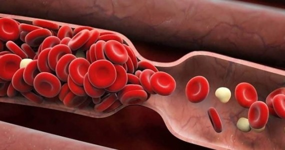 Trombofilie gral_site1